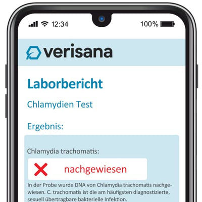 Chlamydien Test für Männer – Schnell, einfach & diskret – Urin-Probe bequem zu Hause abnehmen – Verisana