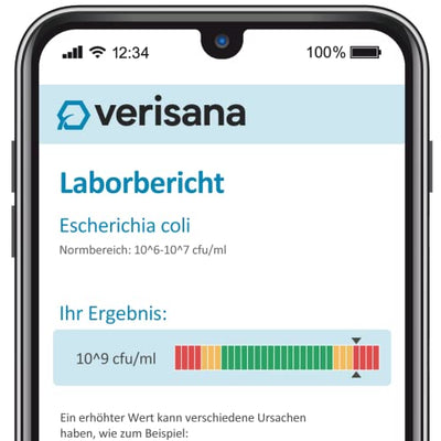 Darmflora Test – Verisana – Stuhltest für zu Hause – Aerobe & anaerobe Darmbakterien, Candida albicans, Candida spec, Geotrichum candidum & Schimmelpilze – Verisana