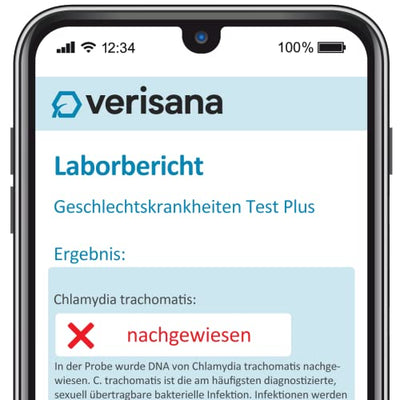 Geschlechtskrankheiten Test Plus für Frauen – Umfassender STI Test auf 9 der häufigsten sexuell übertragbaren Infektionen – Schnell, einfach & diskret von zu Hause – Verisana